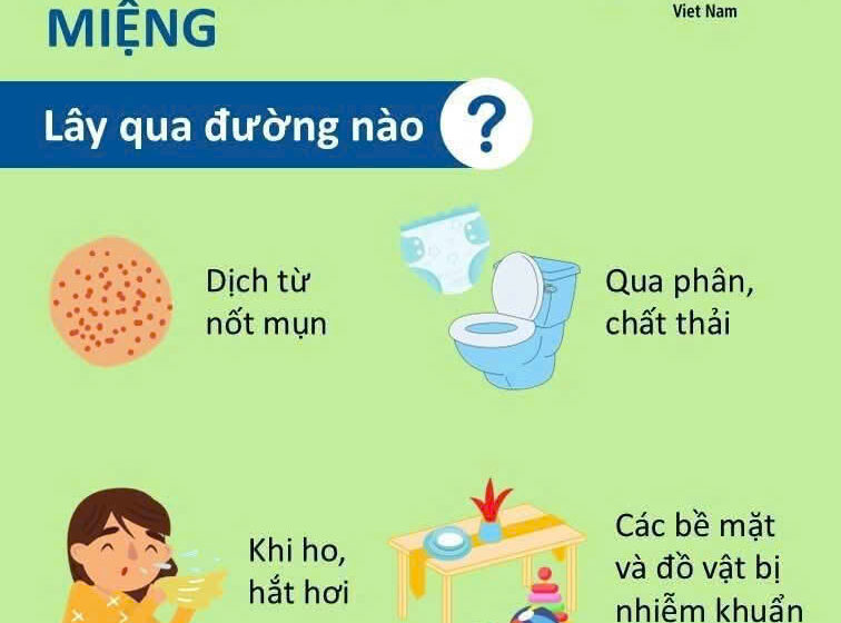  NHỮNG ĐIỀU CẦN BIẾT VỀ BỆNH TAY CHÂN MIỆNG