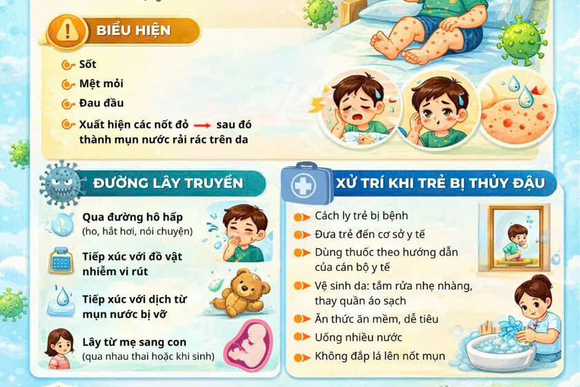  BỆNH THỦY ĐẬU NHỮNG ĐIỀU CẦN BIẾT